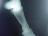 X-ray